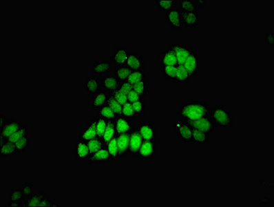 Immunofluorescent analysis of PC-3 cells using MAT2A Antibody at dilution of 1:100 and Alexa Fluor 488-congugated AffiniPure Goat Anti-Rabbit IgG(H+L)