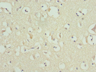 Immunohistochemistry of paraffin-embedded human brain tissue using MATK Antibody at dilution of 1:100
