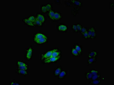 Immunofluorescent analysis of HepG2 cells using MATN3 Antibody at dilution of 1:100 and Alexa Fluor 488-congugated AffiniPure Goat Anti-Rabbit IgG(H+L)