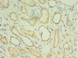 Immunohistochemistry of paraffin-embedded human kidney tissue using the antibody at dilution of 1:100