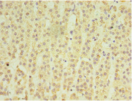 Immunohistochemistry of paraffin-embedded human adrenal gland tissue using MATN3 Antibody at dilution of 1:100