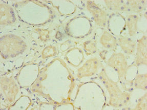 Immunohistochemistry of paraffin-embedded human kidney tissue using MATN3 Antibody at dilution of 1:100