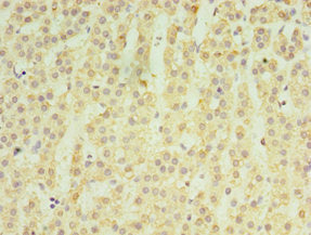 Immunohistochemistry of paraffin-embedded human adrenal gland tissue using MATN3 Antibody at dilution of 1:100