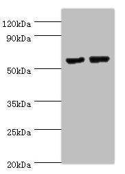 Western blot | All lanes: MATN3 antibody at 14μg/ml | Lane 1: NIH/3T3 whole cell lysate | Lane 2: Mouse thymus tissue | Secondary | Goat polyclonal to rabbit IgG at 1/10000 dilution | Predicted band size: 53, 49 kDa | Observed band size: 53 kDa