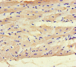 Immunohistochemistry of paraffin-embedded human heart tissue using the antibody at dilution of 1:100