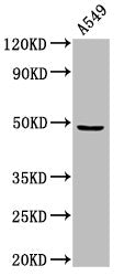 Western Blot  | Positive WB detected in: A549 whole cell lysate  | All lanes: MAZ antibody at 3µg/ml  | Secondary  | Goat polyclonal to rabbit IgG at 1/50000 dilution  | Predicted band size: 49, 52, 47, 18 kDa  | Observed band size: 49 kDa