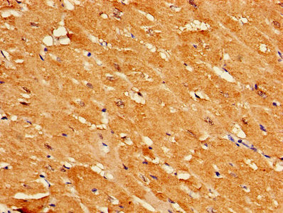 Immunohistochemistry of paraffin-embedded human heart tissue using MB Antibody at dilution of 1:100