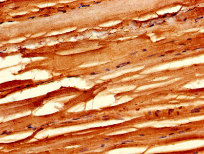 Immunohistochemistry of paraffin-embedded human skeletal muscle tissue using MB Antibody at dilution of 1:100