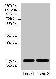 Western blot  | All lanes: MB antibody at 2µg/ml  | Lane 1: Rat heart tissue  | Lane 2: Mouse heart tissue  | Secondary  | Goat polyclonal to rabbit IgG at 1/10000 dilution  | Predicted band size: 18 kDa  | Observed band size: 18 kDa