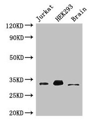 Western Blot  | Positive WB detected in: Jurkat whole cell lysate, HEK293 whole cell lysate, Mouse brain tissue  | All lanes: MBD3 antibody at 3µg/ml  | Secondary  | Goat polyclonal to rabbit IgG at 1/50000 dilution  | Predicted band size: 33, 30 kDa  | Observed band size: 33 kDa