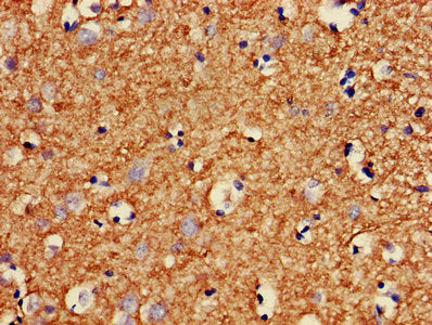 IHC image of MBP Antibody diluted at 1:400 and staining in paraffin-embedded human brain tissue performed on a Leica BondTM system. After dewaxing and hydration, antigen retrieval was mediated by high pressure in a citrate buffer (pH 6.0). Section was blocked with 10% normal goat serum 30min at RT. Then primary antibody (1% BSA) was incubated at 4°C overnight. The primary is detected by a biotinylated secondary antibody and visualized using an HRP conjugated SP system.