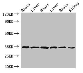 Western Blot | Positive WB detected in: Rat brain tissue, Rat liver tissue, Mouse heart tissue, Mouse liver tissue, Mouse brain tissue, Mouse kidney tissue | All lanes: MBP antibody at 4μg/ml | Secondary | Goat polyclonal to rabbit IgG at 1/50000 dilution | Predicted band size: 34, 22, 21, 19, 18 kDa | Observed band size: 34 kDa
