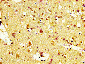 IHC image of MC1R Antibody diluted at 1:400 and staining in paraffin-embedded human brain tissue performed on a Leica BondTM system. After dewaxing and hydration, antigen retrieval was mediated by high pressure in a citrate buffer (pH 6.0). Section was blocked with 10% normal goat serum 30min at RT. Then primary antibody (1% BSA) was incubated at 4°C overnight. The primary is detected by a biotinylated secondary antibody and visualized using an HRP conjugated SP system.