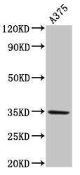 Western Blot  | Positive WB detected in: A375 whole cell lysate  | All lanes: MC1R antibody at 4µg/ml  | Secondary  | Goat polyclonal to rabbit IgG at 1/50000 dilution  | Predicted band size: 35 kDa  | Observed band size: 35 kDa