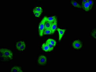Immunofluorescence staining of HepG2 cells with MC3R Antibody at 1:66, counter-stained with DAPI. The cells were fixed in 4% formaldehyde, permeabilized using 0.2% Triton X-100 and blocked in 10% normal Goat Serum. The cells were then incubated with the antibody overnight at 4°C. The secondary antibody was Alexa Fluor 488-congugated AffiniPure Goat Anti-Rabbit IgG(H+L).