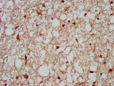 IHC image of MC3R Antibody diluted at 1:200 and staining in paraffin-embedded human brain tissue performed on a Leica BondTM system. After dewaxing and hydration, antigen retrieval was mediated by high pressure in a citrate buffer (pH 6.0). Section was blocked with 10% normal goat serum 30min at RT. Then primary antibody (1% BSA) was incubated at 4°C overnight. The primary is detected by a biotinylated secondary antibody and visualized using an HRP conjugated SP system.