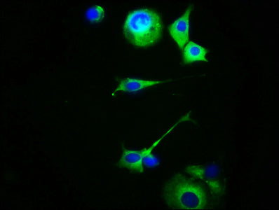Immunofluorescence staining of MCF-7 cells with MC5R Antibody at 1:100, counter-stained with DAPI. The cells were fixed in 4% formaldehyde, permeabilized using 0.2% Triton X-100 and blocked in 10% normal Goat Serum. The cells were then incubated with the antibody overnight at 4°C. The secondary antibody was Alexa Fluor 488-congugated AffiniPure Goat Anti-Rabbit IgG(H+L).
