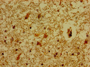 Immunohistochemistry of paraffin-embedded human brain tissue using MC5R Antibody at dilution of 1:100