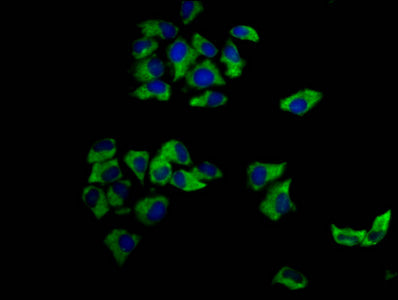 Immunofluorescence staining of Hela cells with MCC Antibody at 1:166, counter-stained with DAPI. The cells were fixed in 4% formaldehyde, permeabilized using 0.2% Triton X-100 and blocked in 10% normal Goat Serum. The cells were then incubated with the antibody overnight at 4°C. The secondary antibody was Alexa Fluor 488-congugated AffiniPure Goat Anti-Rabbit IgG(H+L).