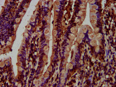IHC image of the antibody diluted at 1:500 and staining in paraffin-embedded human small intestine tissue performed on a Leica BondTM system. After dewaxing and hydration, antigen retrieval was mediated by high pressure in a citrate buffer (pH 6.0). Section was blocked with 10% normal goat serum 30min at RT. Then primary antibody (1% BSA) was incubated at 4°C overnight. The primary is detected by a biotinylated secondary antibody and visualized using an HRP conjugated SP system.