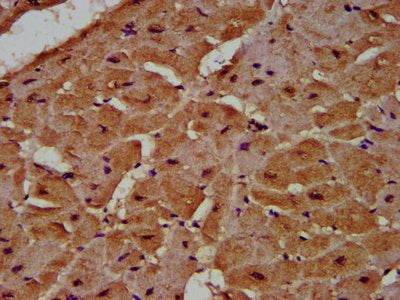 IHC image of MCC Antibody diluted at 1:500 and staining in paraffin-embedded human heart tissue performed on a Leica BondTM system. After dewaxing and hydration, antigen retrieval was mediated by high pressure in a citrate buffer (pH 6.0). Section was blocked with 10% normal goat serum 30min at RT. Then primary antibody (1% BSA) was incubated at 4°C overnight. The primary is detected by a biotinylated secondary antibody and visualized using an HRP conjugated SP system.