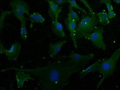 Immunofluorescence staining of U251 cells with MCF2 Antibody at 1:50, counter-stained with DAPI. The cells were fixed in 4% formaldehyde, permeabilized using 0.2% Triton X-100 and blocked in 10% normal Goat Serum. The cells were then incubated with the antibody overnight at 4°C. The secondary antibody was Alexa Fluor 488-congugated AffiniPure Goat Anti-Rabbit IgG(H+L).