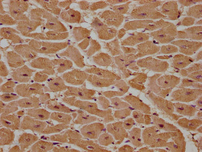 IHC image of the antibody diluted at 1:100 and staining in paraffin-embedded human heart tissue performed on a Leica BondTM system. After dewaxing and hydration, antigen retrieval was mediated by high pressure in a citrate buffer (pH 6.0). Section was blocked with 10% normal goat serum 30min at RT. Then primary antibody (1% BSA) was incubated at 4°C overnight. The primary is detected by a biotinylated secondary antibody and visualized using an HRP conjugated SP system.