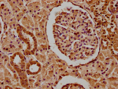IHC image of MCF2 Antibody diluted at 1:100 and staining in paraffin-embedded human kidney tissue performed on a Leica BondTM system. After dewaxing and hydration, antigen retrieval was mediated by high pressure in a citrate buffer (pH 6.0). Section was blocked with 10% normal goat serum 30min at RT. Then primary antibody (1% BSA) was incubated at 4°C overnight. The primary is detected by a biotinylated secondary antibody and visualized using an HRP conjugated SP system.