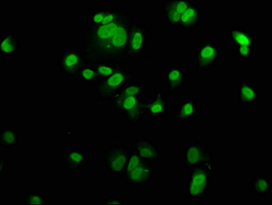 Immunofluorescence staining of MCF-7 cells with MCM2 Antibody at 1:200, counter-stained with DAPI. The cells were fixed in 4% formaldehyde, permeabilized using 0.2% Triton X-100 and blocked in 10% normal Goat Serum. The cells were then incubated with the antibody overnight at 4°C. The secondary antibody was Alexa Fluor 488-congugated AffiniPure Goat Anti-Rabbit IgG(H+L).