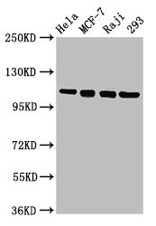 Western Blot  | Positive WB detected in: Hela whole cell lysate, MCF-7 whole cell lysate, Raji whole cell lysate, 293 whole cell lysate  | All lanes: MCM2 antibody at 4.8µg/ml  | Secondary  | Goat polyclonal to rabbit IgG at 1/50000 dilution  | Predicted band size: 102 kDa  | Observed band size: 102 kDa