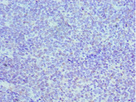 Immunohistochemistry of paraffin-embedded human tonsil tissue using MCM3 Antibody at dilution of 1:100