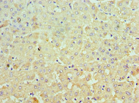 Immunohistochemistry of paraffin-embedded human liver tissue using MCM3 Antibody at dilution of 1:100