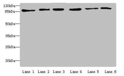 Western blot | All lanes: MCM3 antibody at 4 μg/ml | Lane 1: Hela whole cell lysate | Lane 2: 293T whole cell lysate | Lane 3: K562 whole cell lysate | Lane 4: HepG2 whole cell lysate | Lane 5: Jurkats whole cell lysate | Lane 6: U917 whole cell lysate | Secondary | Goat polyclonal to rabbit IgG at 1/10000 dilution | Predicted band size: 91, 96 kDa | Observed band size: 91 kDa