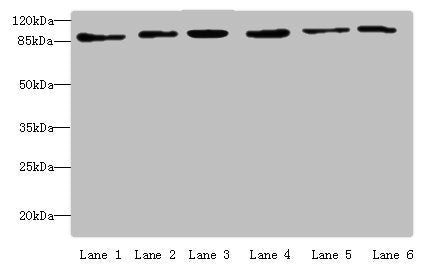 Western blot | All lanes: MCM3 antibody at 4 μg/ml | Lane 1: Hela whole cell lysate | Lane 2: 293T whole cell lysate | Lane 3: K562 whole cell lysate | Lane 4: HepG2 whole cell lysate | Lane 5: Jurkats whole cell lysate | Lane 6: U917 whole cell lysate | Secondary | Goat polyclonal to rabbit IgG at 1/10000 dilution | Predicted band size: 91, 96 kDa | Observed band size: 91 kDa