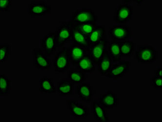 Immunofluorescence staining of A549 cells with MCM4 Antibody at 1:100, counter-stained with DAPI. The cells were fixed in 4% formaldehyde, permeabilized using 0.2% Triton X-100 and blocked in 10% normal Goat Serum. The cells were then incubated with the antibody overnight at 4°C. The secondary antibody was Alexa Fluor 488-congugated AffiniPure Goat Anti-Rabbit IgG(H+L).