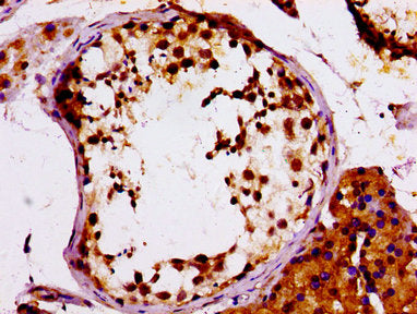IHC image of MCM4 Antibody diluted at 1:100 and staining in paraffin-embedded human testis tissue performed on a Leica BondTM system. After dewaxing and hydration, antigen retrieval was mediated by high pressure in a citrate buffer (pH 6.0). Section was blocked with 10% normal goat serum 30min at RT. Then primary antibody (1% BSA) was incubated at 4°C overnight. The primary is detected by a biotinylated secondary antibody and visualized using an HRP conjugated SP system.