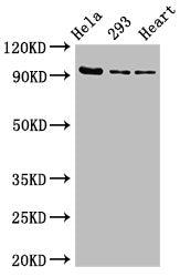 Western Blot  | Positive WB detected in: Hela whole cell lysate, 293 whole cell lysate, Rat heart tissue  | All lanes: MCM4 antibody at 2.7µg/ml  | Secondary  | Goat polyclonal to rabbit IgG at 1/50000 dilution  | Predicted band size: 97 kDa  | Observed band size: 97 kDa