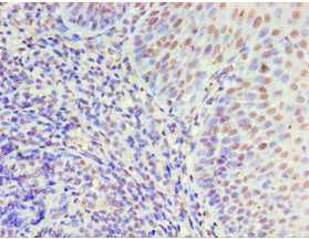 Immunohistochemistry of paraffin-embedded human tonsil tissue using MCM5 Antibody at dilution of 1:100