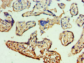 Immunohistochemistry of paraffin-embedded human placenta tissue using MCM5 Antibody at dilution of 1:100