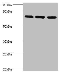 Western blot | All lanes: DNA replication licensing factor MCM5 antibody at 3μg/ml | Lane 1: Hela whole cell lysate | Lane 2: MCF-7 whole cell lysate | Lane 2: Mouse thymus tissue | Secondary | Goat polyclonal to rabbit IgG at 1/10000 dilution | Predicted band size: 82 kDa | Observed band size: 82 kDa
