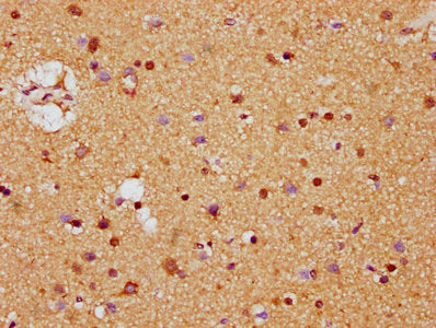 IHC image of MDH1 Antibody diluted at 1:400 and staining in paraffin-embedded human brain tissue performed on a Leica BondTM system. After dewaxing and hydration, antigen retrieval was mediated by high pressure in a citrate buffer (pH 6.0). Section was blocked with 10% normal goat serum 30min at RT. Then primary antibody (1% BSA) was incubated at 4°C overnight. The primary is detected by a biotinylated secondary antibody and visualized using an HRP conjugated SP system.