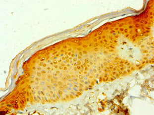 Immunohistochemistry of paraffin-embedded human skin tissue using MDH1 Antibody at dilution of 1:100