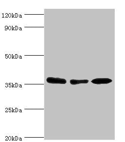 Western blot | All lanes: MDH1 antibody at 4μg/ml | Lane 1: HepG2 whole cell lysate | Lane 2: Hela whole cell lysate | Lane 3: Mouse kidney tissue | Secondary | Goat polyclonal to rabbit IgG at 1/10000 dilution | Predicted band size: 37, 28, 39 kDa | Observed band size: 37 kDa