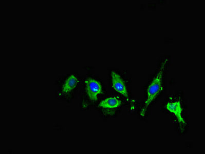 Immunofluorescent analysis of Hela cells using ME1 Antibody at dilution of 1:100 and Alexa Fluor 488-congugated AffiniPure Goat Anti-Rabbit IgG(H+L)