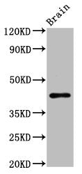 Western Blot | Positive WB detected in: Rat brain tissue | All lanes: METAP1 antibody at 6.2μg/ml | Secondary | Goat polyclonal to rabbit IgG at 1/50000 dilution | Predicted band size: 44 kDa | Observed band size: 44 kDa