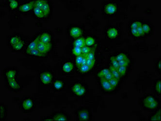 Immunofluorescence staining of HepG2 cells with METAP2 Antibody at 1:100, counter-stained with DAPI. The cells were fixed in 4% formaldehyde, permeabilized using 0.2% Triton X-100 and blocked in 10% normal Goat Serum. The cells were then incubated with the antibody overnight at 4°C. The secondary antibody was Alexa Fluor 488-congugated AffiniPure Goat Anti-Rabbit IgG(H+L).