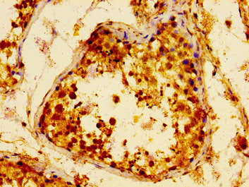 IHC image of METAP2 Antibody diluted at 1:100 and staining in paraffin-embedded human testis tissue performed on a Leica BondTM system. After dewaxing and hydration, antigen retrieval was mediated by high pressure in a citrate buffer (pH 6.0). Section was blocked with 10% normal goat serum 30min at RT. Then primary antibody (1% BSA) was incubated at 4°C overnight. The primary is detected by a biotinylated secondary antibody and visualized using an HRP conjugated SP system.