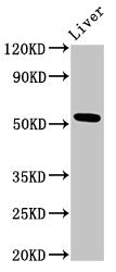 Western Blot | Positive WB detected in: Rat liver tissue | All lanes: METAP2 antibody at 3μg/ml | Secondary | Goat polyclonal to rabbit IgG at 1/50000 dilution | Predicted band size: 53, 52, 51 kDa | Observed band size: 53 kDa