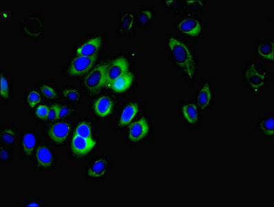 Immunofluorescent analysis of A549 cells using MFAP3L Antibody at dilution of 1:100 and Alexa Fluor 488-congugated AffiniPure Goat Anti-Rabbit IgG(H+L)