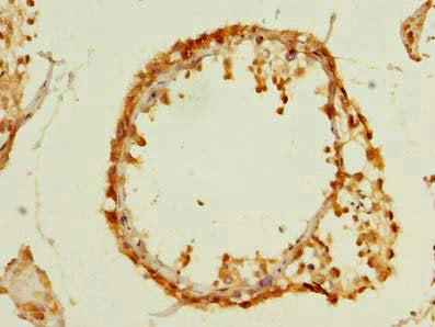 Immunohistochemistry of paraffin-embedded human testis tissue using MFAP3L Antibody at dilution of 1:100